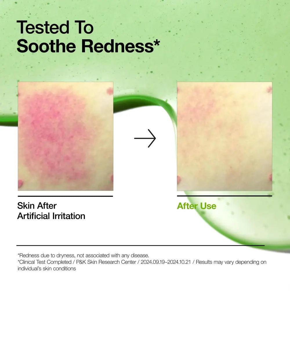 Anua - Azelaic Acid 10+ Hyaluron Sérum hydratant KskinRitual